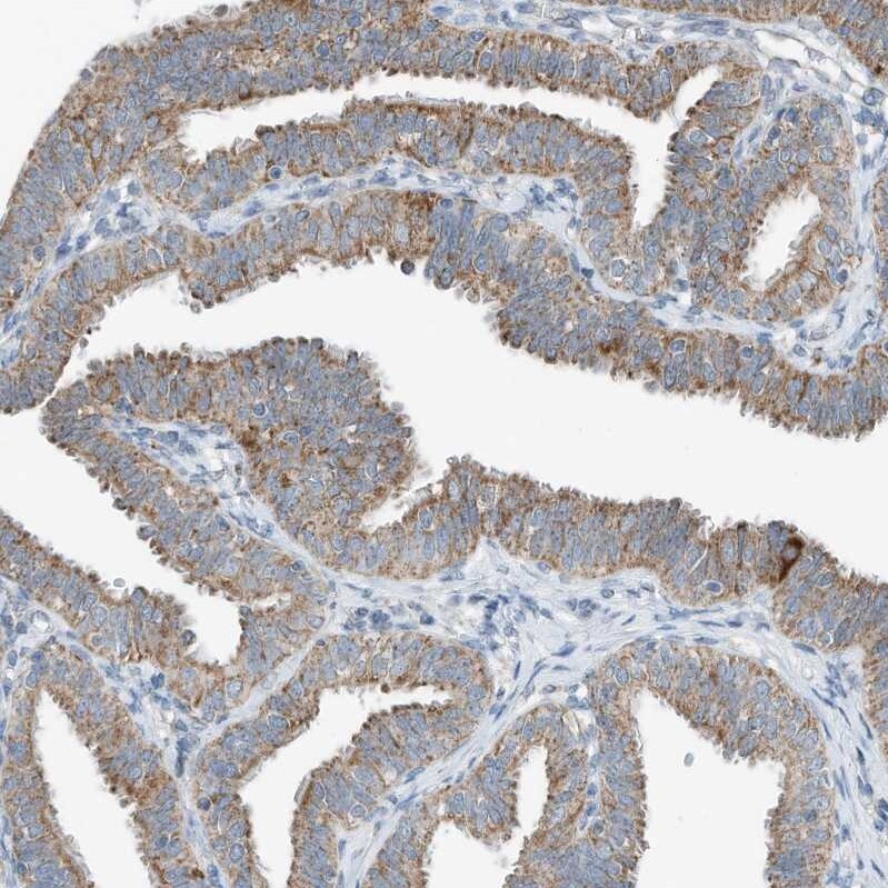 RMND1 Antibody - BSA Free Immunohistochemistry-Paraffin: RMND1 Antibody [NBP2-33951]