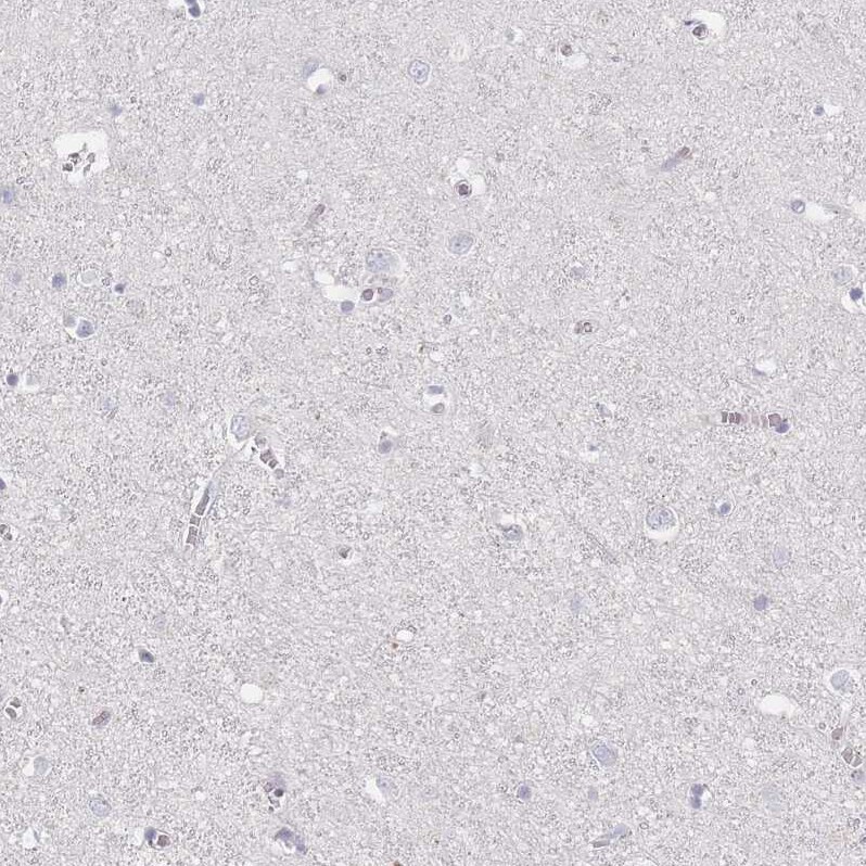CD37 Antibody - BSA Free Immunohistochemistry-Paraffin: CD37 Antibody [NBP2-33970]