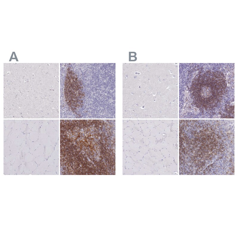 CD37 Antibody - BSA Free Immunohistochemistry-Paraffin: CD37 Antibody [NBP2-33970]