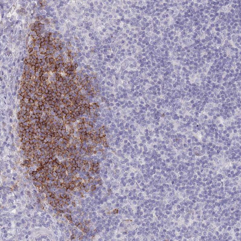 CD37 Antibody - BSA Free Immunohistochemistry-Paraffin: CD37 Antibody [NBP2-33970]