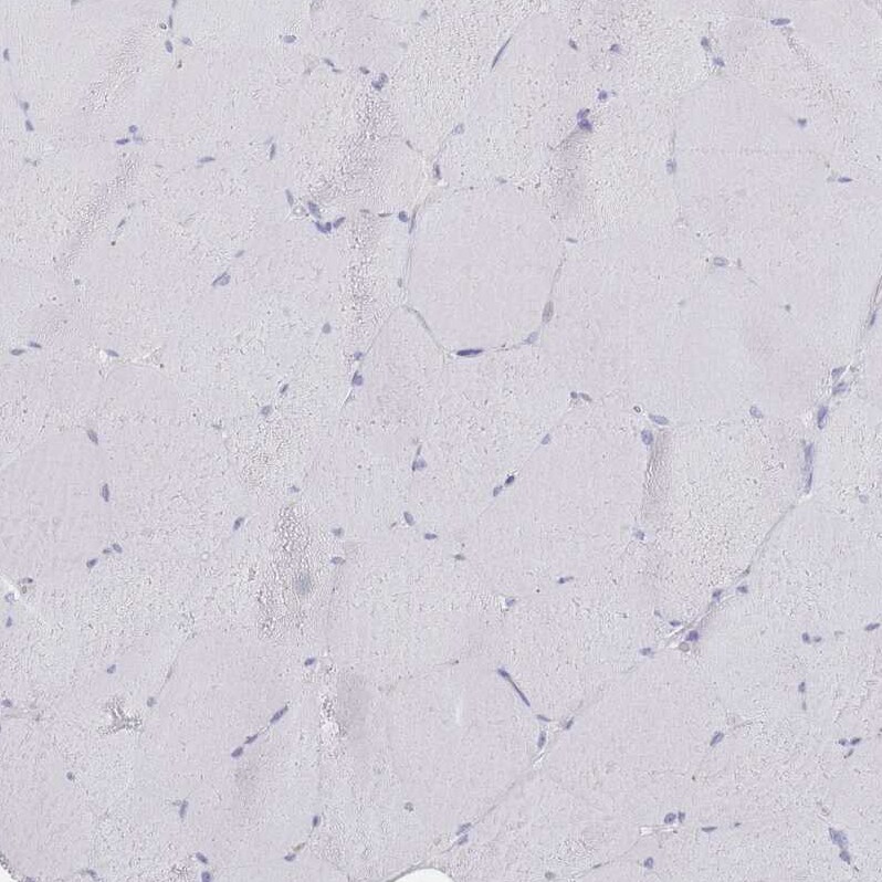 CD37 Antibody - BSA Free Immunohistochemistry-Paraffin: CD37 Antibody [NBP2-33970]