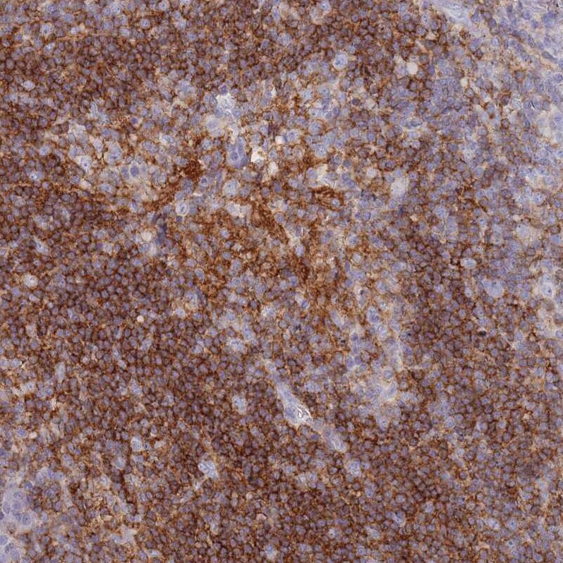 CD37 Antibody - BSA Free Immunohistochemistry-Paraffin: CD37 Antibody [NBP2-33970]