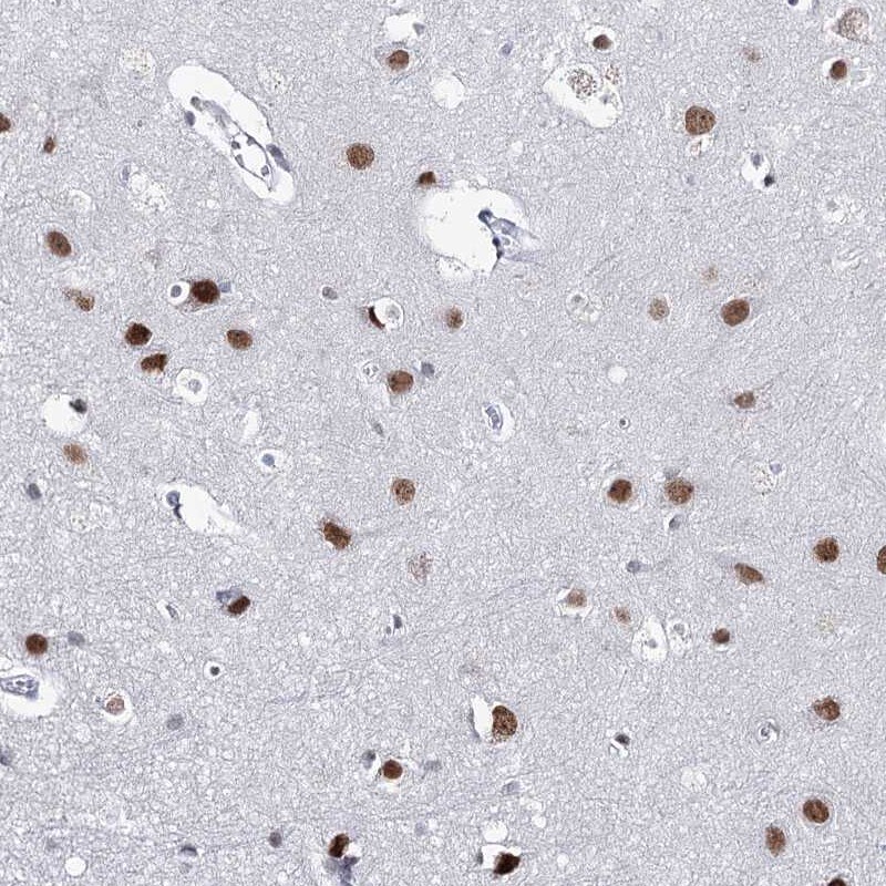 ZC3H8 Antibody - BSA Free Immunohistochemistry-Paraffin: ZC3H8 Antibody [NBP2-33980]
