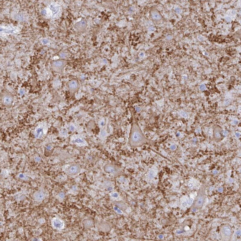 GluR1 Antibody - BSA Free Immunohistochemistry: GluR1 Antibody - BSA Free [NBP2-33996]