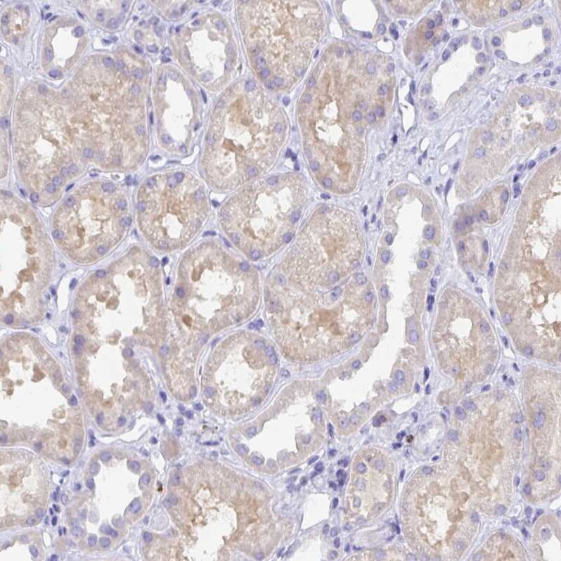 GluR1 Antibody - BSA Free Immunohistochemistry: GluR1 Antibody - BSA Free [NBP2-33996]