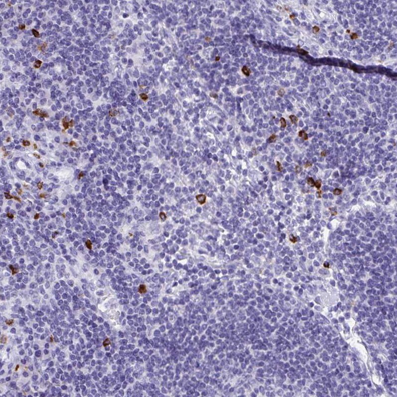 GluR1 Antibody - BSA Free Immunohistochemistry: GluR1 Antibody - BSA Free [NBP2-33996]
