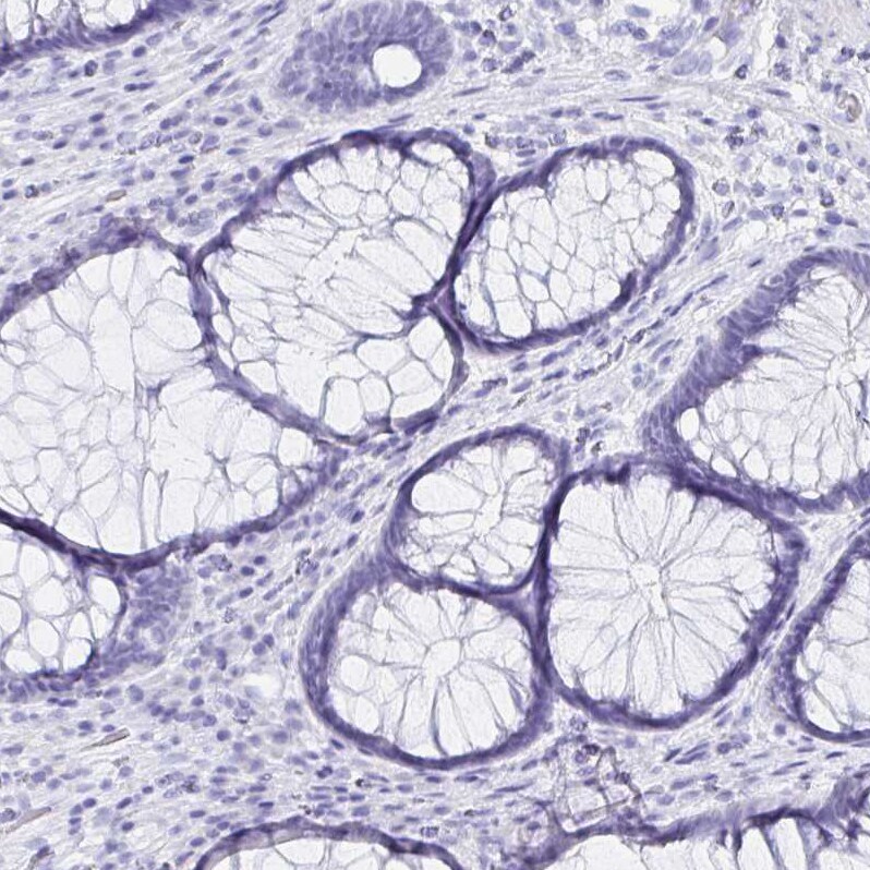 GluR1 Antibody - BSA Free Immunohistochemistry: GluR1 Antibody - BSA Free [NBP2-33996]