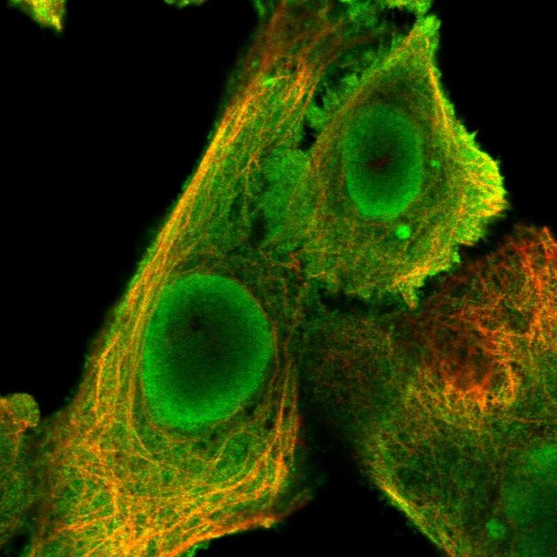 DjC9 Antibody - BSA Free Immunocytochemistry/ Immunofluorescence: DjC9 Antibody [NBP2-33997]