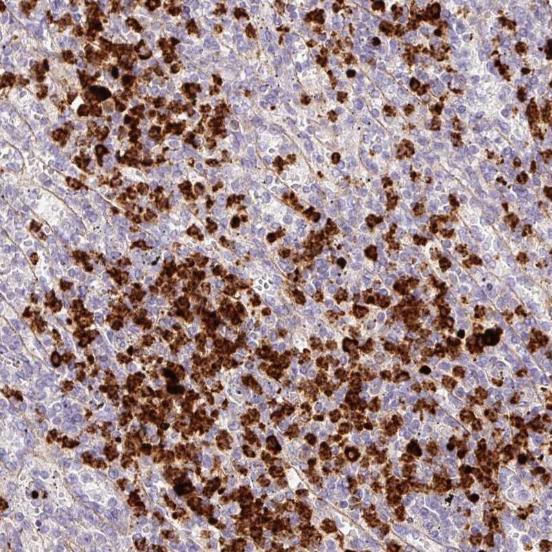 MEKK3 Antibody - BSA Free Immunohistochemistry: MEKK3 Antibody - BSA Free [NBP2-34004]