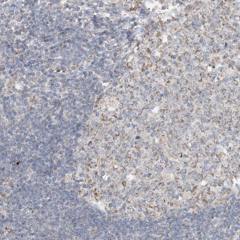 SFMBT2 Antibody - BSA Free Immunohistochemistry-Paraffin: SFMBT2 Antibody [NBP2-34005]