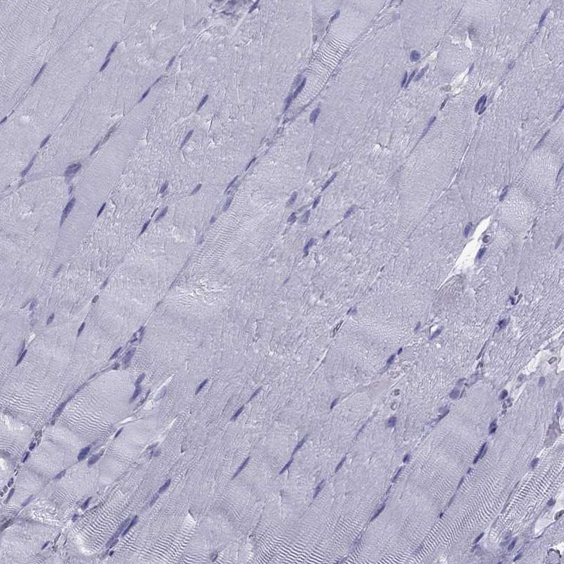 TFF3 Antibody - BSA Free Immunohistochemistry-Paraffin: TFF3 Antibody [NBP2-34007]