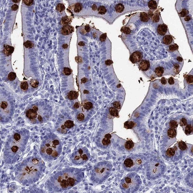 TFF3 Antibody - BSA Free Immunohistochemistry-Paraffin: TFF3 Antibody [NBP2-34007]