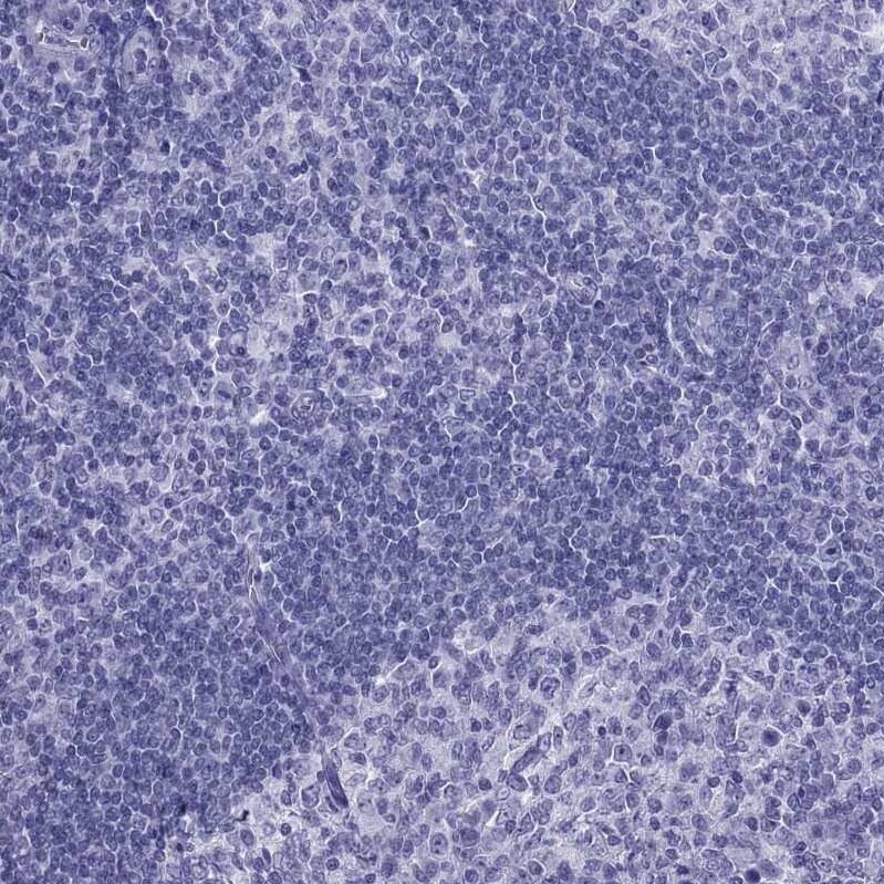 TFF3 Antibody - BSA Free Immunohistochemistry-Paraffin: TFF3 Antibody [NBP2-34007]