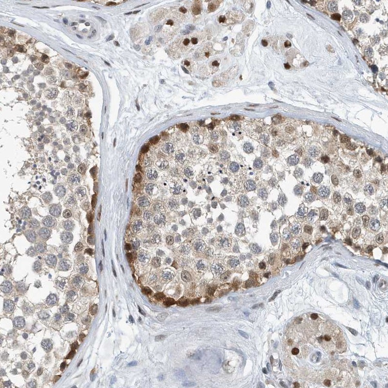 KIF15 Antibody - BSA Free Immunohistochemistry: KIF15 Antibody - BSA Free [NBP2-34009]