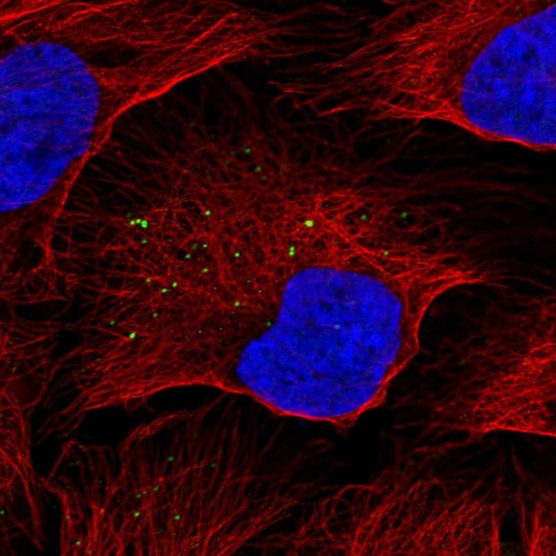 KISS1 Antibody - BSA Free Immunocytochemistry/ Immunofluorescence: KISS1 Antibody [NBP2-34010]