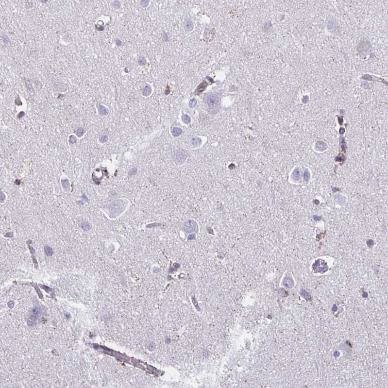 Thyrotropin Releasing Hormone Antibody - BSA Free Immunohistochemistry-Paraffin: Thyrotropin Releasing Hormone Antibody [NBP2-34014]
