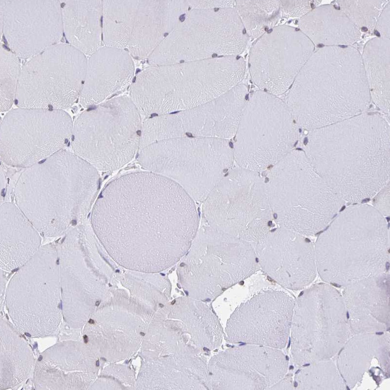 Thyrotropin Releasing Hormone Antibody - BSA Free Immunohistochemistry-Paraffin: Thyrotropin Releasing Hormone Antibody [NBP2-34014]
