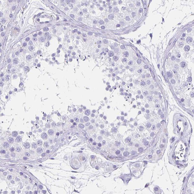 Thyrotropin Releasing Hormone Antibody - BSA Free Immunohistochemistry-Paraffin: Thyrotropin Releasing Hormone Antibody [NBP2-34014]