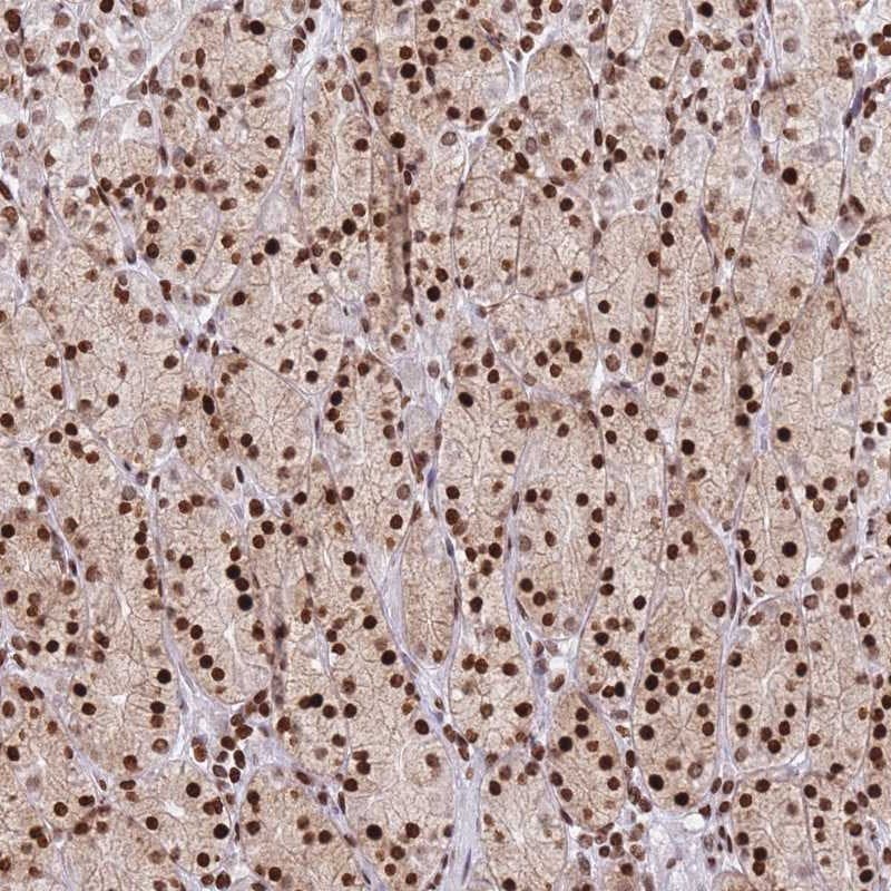 AKD1 Antibody - BSA Free Immunohistochemistry: AKD1 Antibody - BSA Free [NBP2-34029]