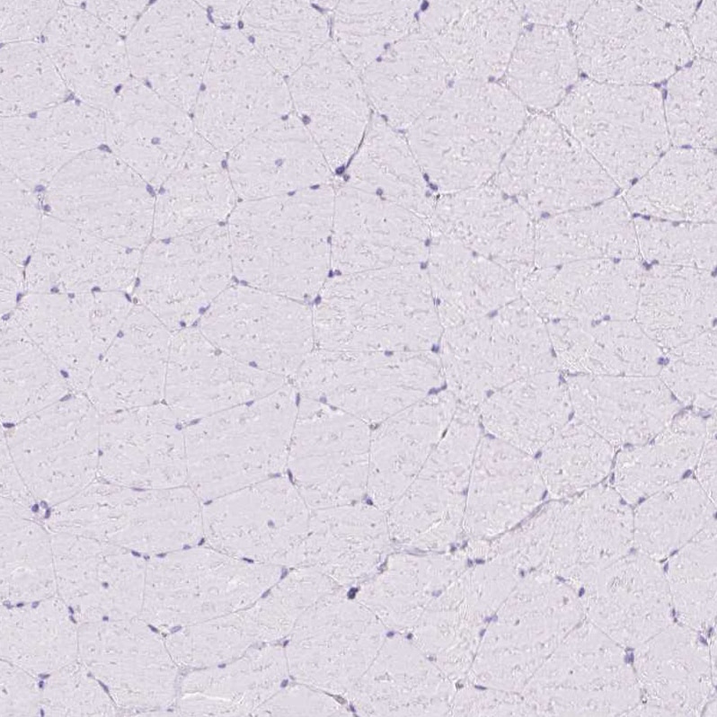 TFF2 Antibody - BSA Free Immunohistochemistry-Paraffin: TFF2 Antibody [NBP2-34032]