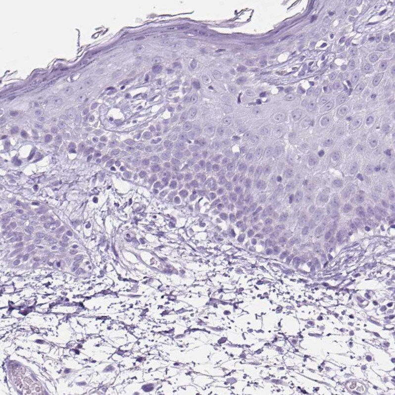 TFF2 Antibody - BSA Free Immunohistochemistry-Paraffin: TFF2 Antibody [NBP2-34032]
