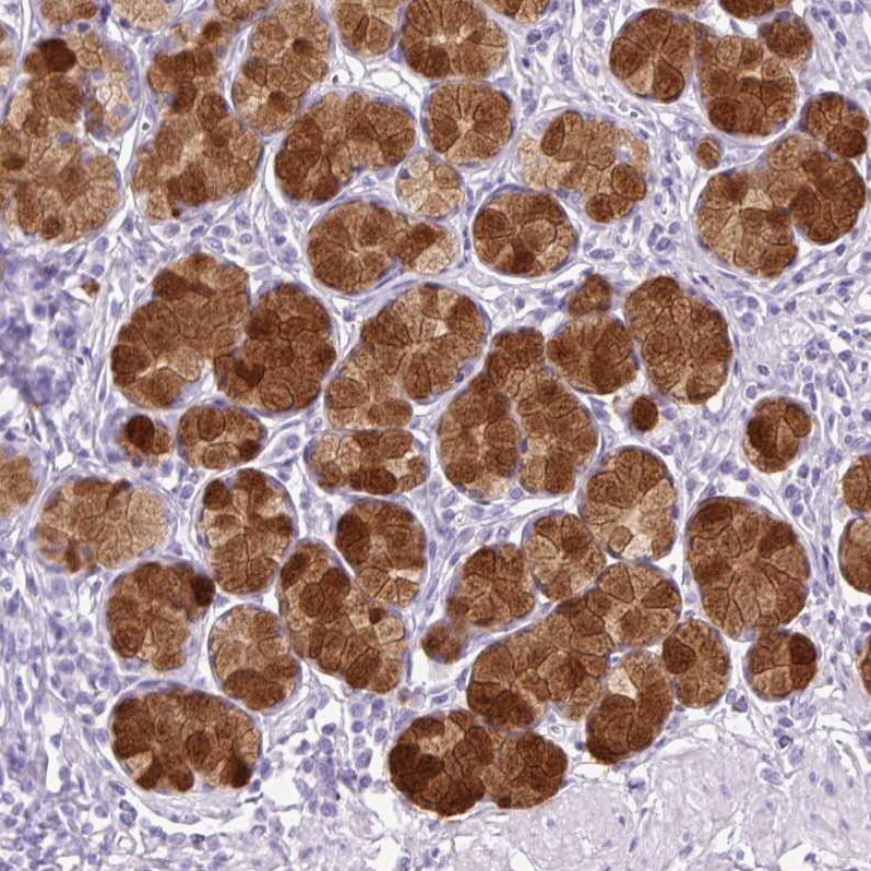 TFF2 Antibody - BSA Free Immunohistochemistry-Paraffin: TFF2 Antibody [NBP2-34032]