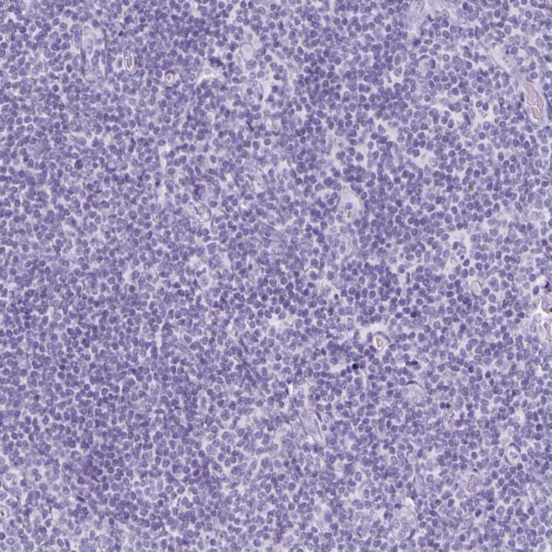 TFF2 Antibody - BSA Free Immunohistochemistry-Paraffin: TFF2 Antibody [NBP2-34032]