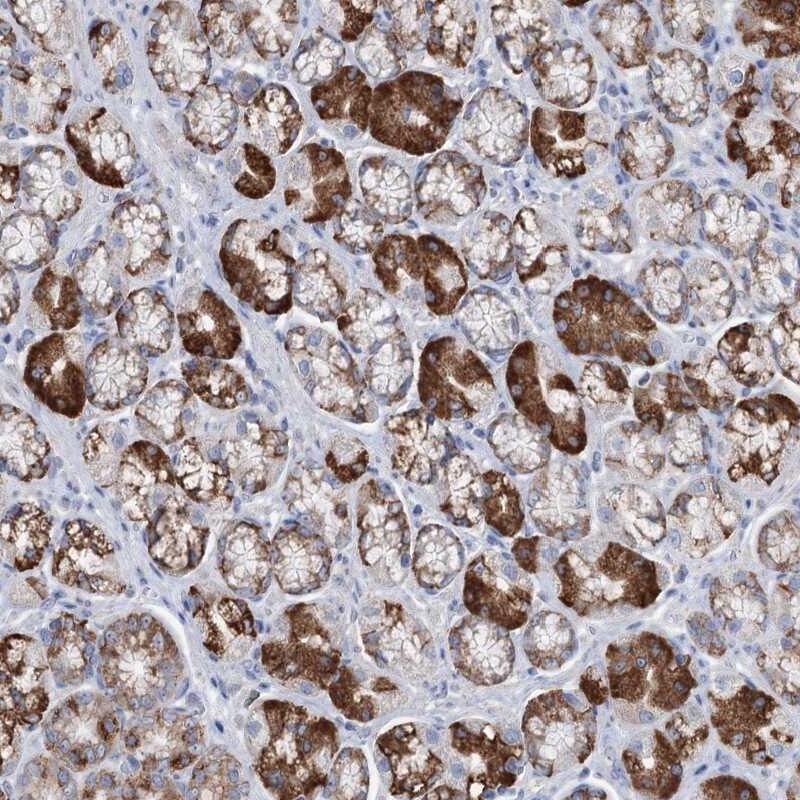 LIN-41/TRIM71 Antibody - BSA Free Immunohistochemistry: LIN-41/TRIM71 Antibody - BSA Free [NBP2-34043]
