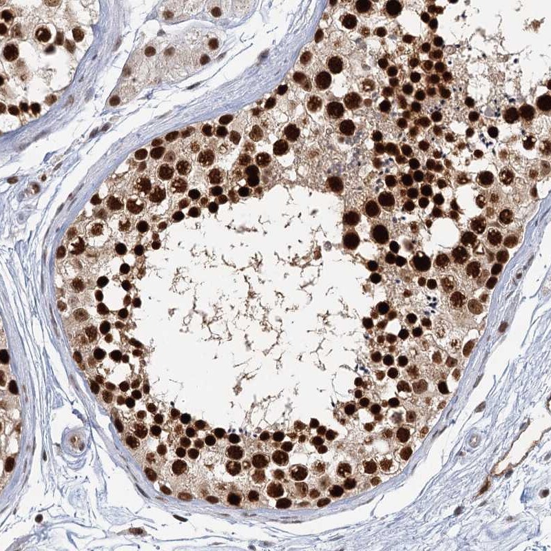 CCDC75 Antibody - BSA Free Immunohistochemistry-Paraffin: CCDC75 Antibody [NBP2-34044]