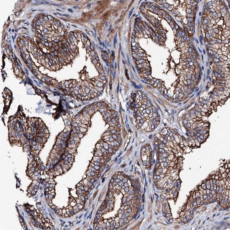 LRRC35 Antibody - BSA Free Immunohistochemistry-Paraffin: LRRC35 Antibody [NBP2-34051]