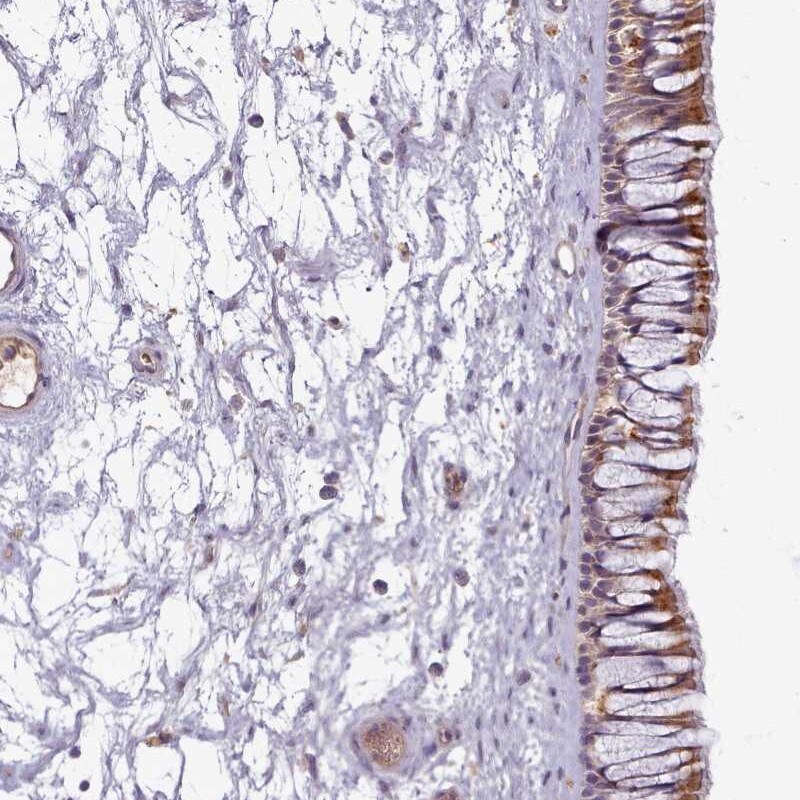 C1qTNF5/CTRP5 Antibody - BSA Free Immunohistochemistry: C1qTNF5/CTRP5 Antibody - BSA Free [NBP2-34052]