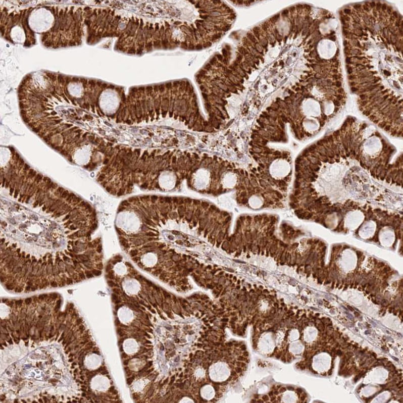HSP10/EPF Antibody - BSA Free Immunohistochemistry-Paraffin: HSP10/EPF Antibody [NBP2-34055]