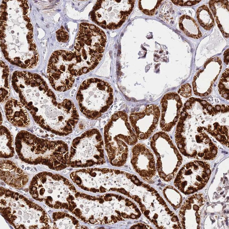 HSP10/EPF Antibody - BSA Free Immunohistochemistry-Paraffin: HSP10/EPF Antibody [NBP2-34055]