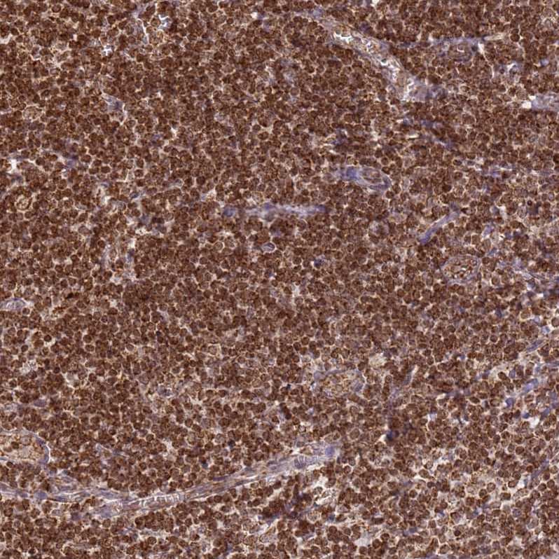 HSP10/EPF Antibody - BSA Free Immunohistochemistry-Paraffin: HSP10/EPF Antibody [NBP2-34055]