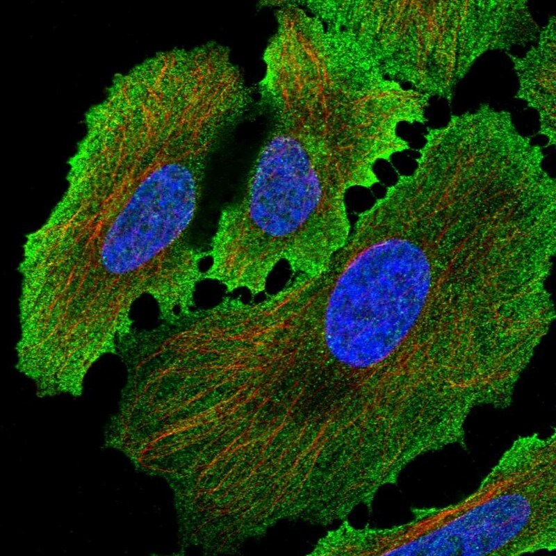 Alkaline Phosphatase/ALPP Antibody - BSA Free Immunocytochemistry/ Immunofluorescence: Alkaline Phosphatase/ALPP Antibody [NBP2-34056]