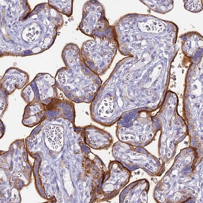 Alkaline Phosphatase, Intestinal Antibody - BSA Free Immunohistochemistry: Alkaline Phosphatase, Intestinal Antibody - BSA Free [NBP2-34057]