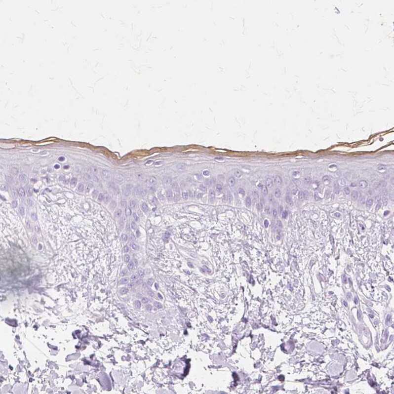 Transglutaminase 1/TGM1 Antibody - BSA Free Immunohistochemistry-Paraffin: Transglutaminase 1/TGM1 Antibody [NBP2-34062]
