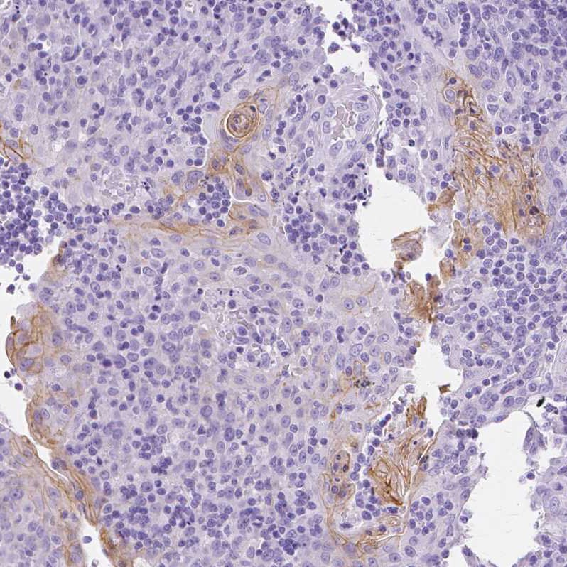 Transglutaminase 1/TGM1 Antibody - BSA Free Immunohistochemistry-Paraffin: Transglutaminase 1/TGM1 Antibody [NBP2-34062]