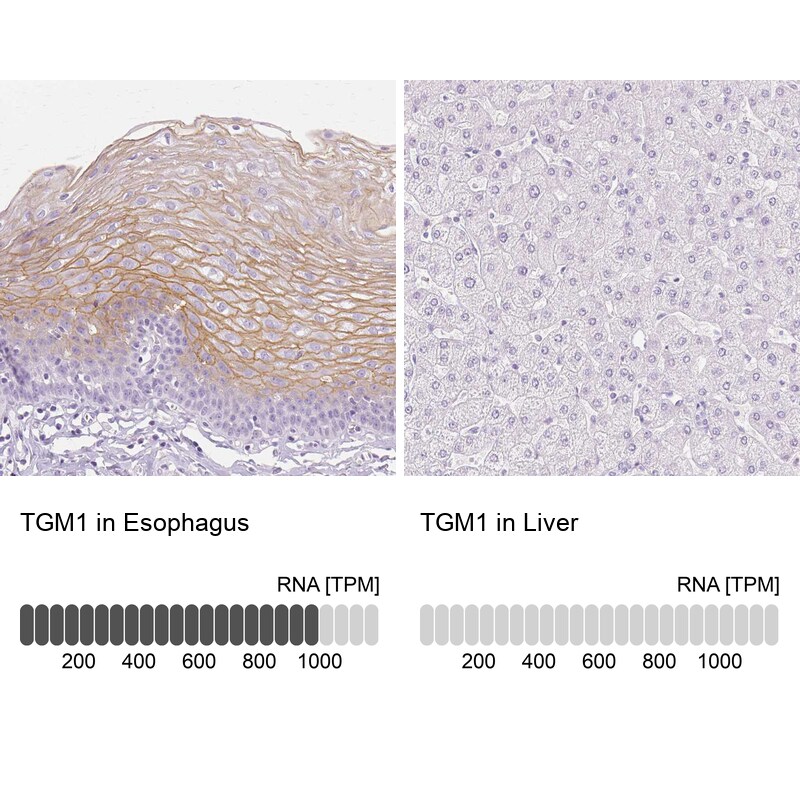 Transglutaminase 1/TGM1 Antibody - BSA Free Immunohistochemistry-Paraffin: Transglutaminase 1/TGM1 Antibody [NBP2-34062]