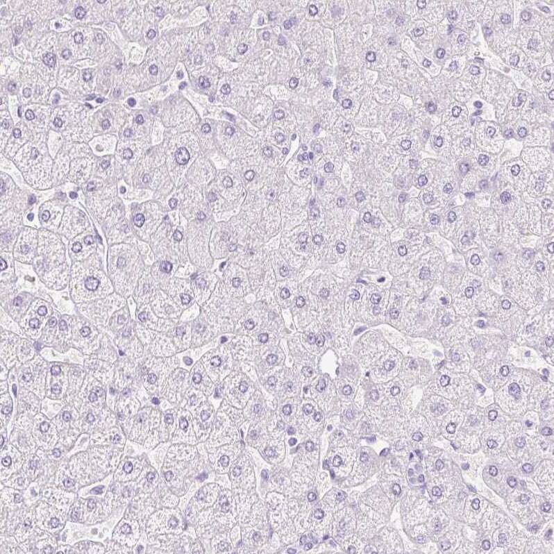 Transglutaminase 1/TGM1 Antibody - BSA Free Immunohistochemistry-Paraffin: Transglutaminase 1/TGM1 Antibody [NBP2-34062]