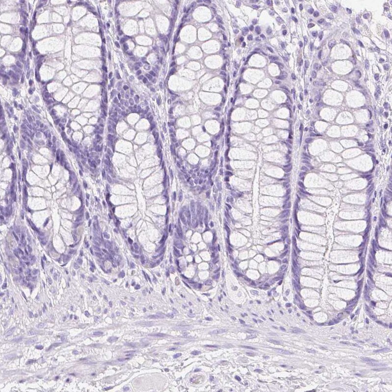 Transglutaminase 1/TGM1 Antibody - BSA Free Immunohistochemistry-Paraffin: Transglutaminase 1/TGM1 Antibody [NBP2-34062]
