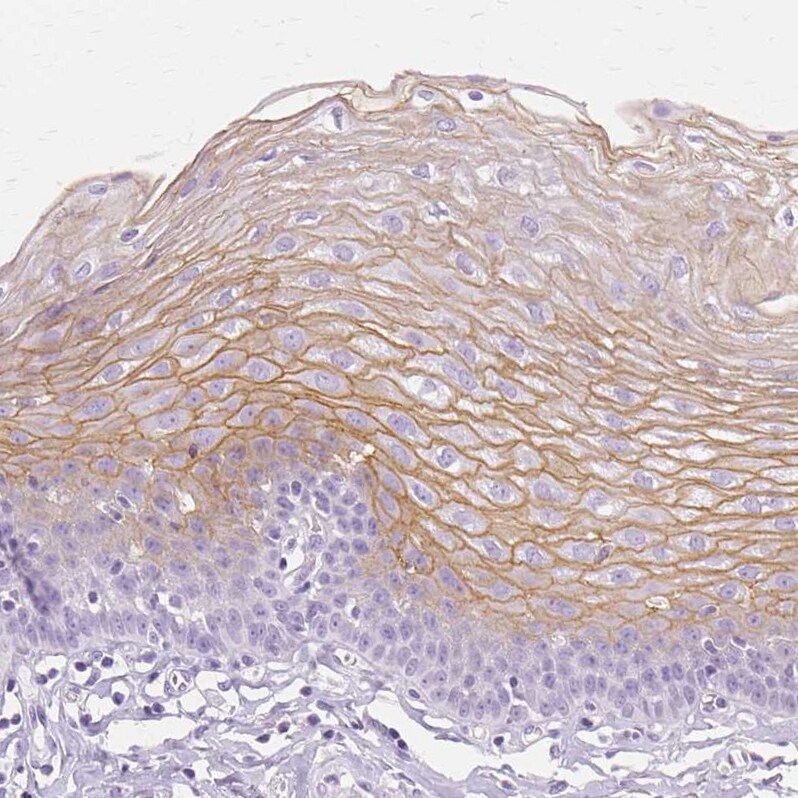 Transglutaminase 1/TGM1 Antibody - BSA Free Immunohistochemistry-Paraffin: Transglutaminase 1/TGM1 Antibody [NBP2-34062]