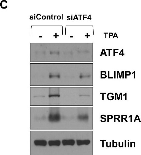 Transglutaminase 1/TGM1 Antibody - BSA Free