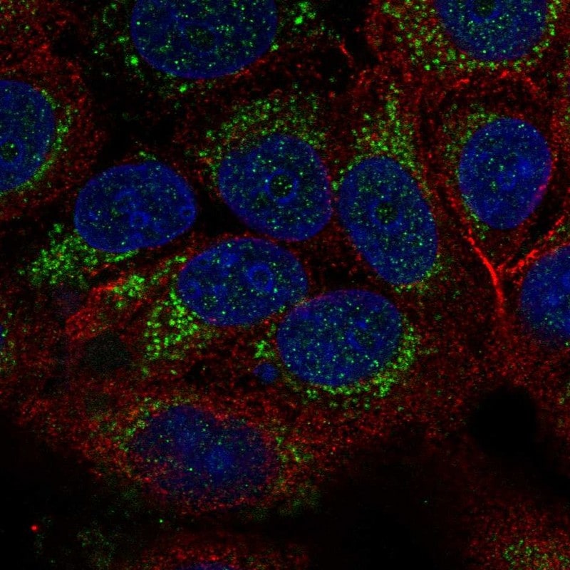 TID1 Antibody - BSA Free Immunocytochemistry/ Immunofluorescence: TID1 Antibody [NBP2-34066]