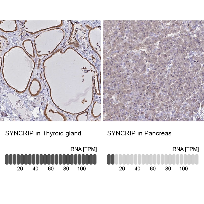 hnRNP-Q Antibody - BSA Free Immunohistochemistry-Paraffin: hnRNP-Q Antibody [NBP2-34068]