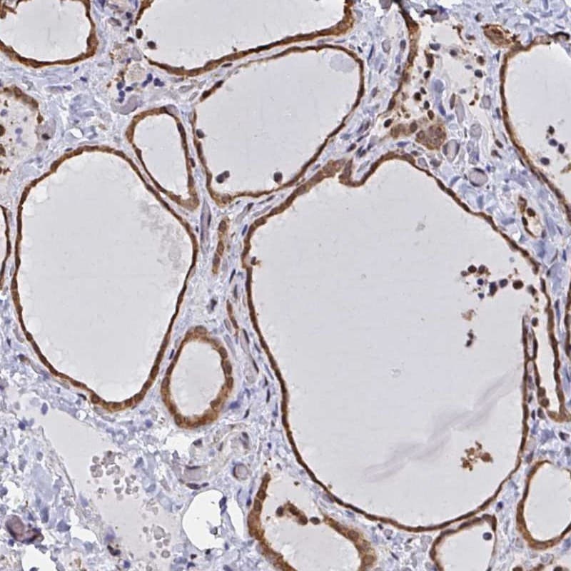 hnRNP-Q Antibody - BSA Free Immunohistochemistry-Paraffin: hnRNP-Q Antibody [NBP2-34068]
