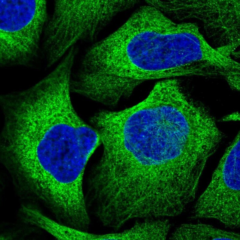 Glycogen Synthase Antibody - BSA Free Immunocytochemistry/ Immunofluorescence: Glycogen Synthase Antibody [NBP2-34071]