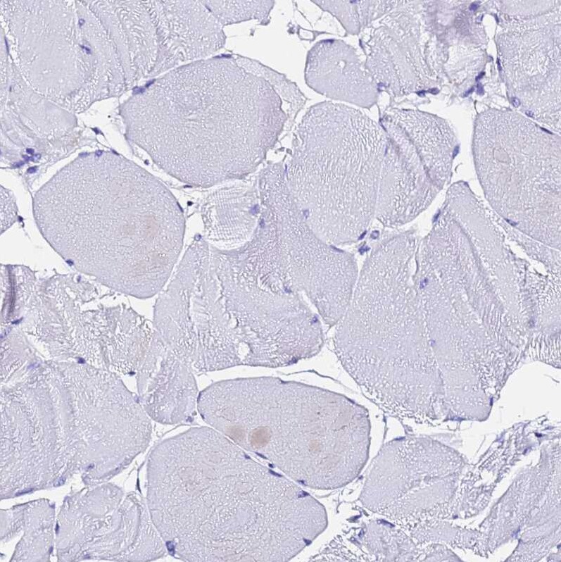 Ferritin Light Chain Antibody - BSA Free Immunohistochemistry-Paraffin: Ferritin Light Chain Antibody [NBP2-34072]