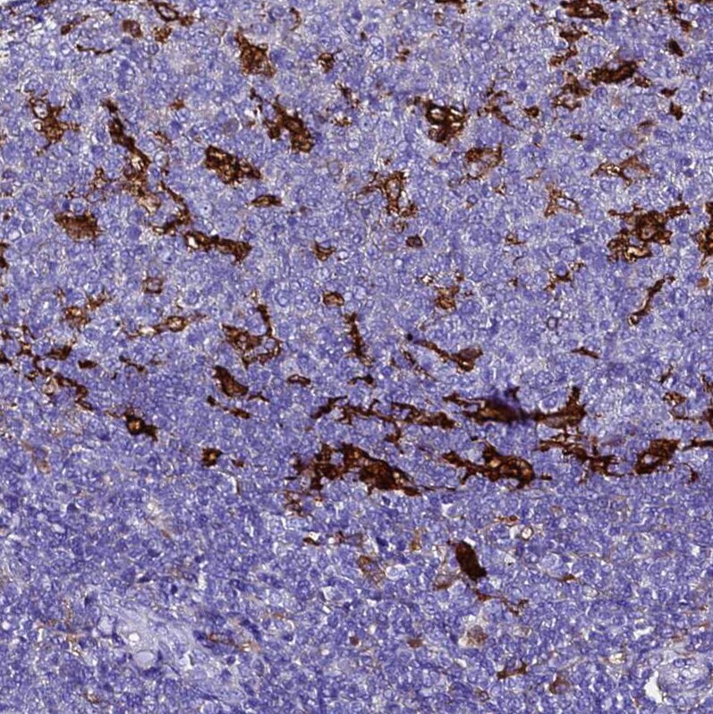 Ferritin Light Chain Antibody - BSA Free Immunohistochemistry-Paraffin: Ferritin Light Chain Antibody [NBP2-34072]