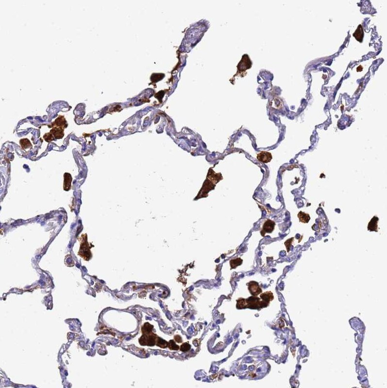 Ferritin Light Chain Antibody - BSA Free Immunohistochemistry-Paraffin: Ferritin Light Chain Antibody [NBP2-34072]